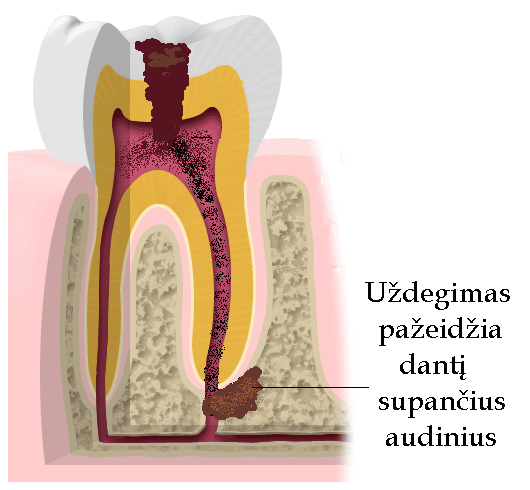 Natural desinio sono skausmas pereinantis i nugara